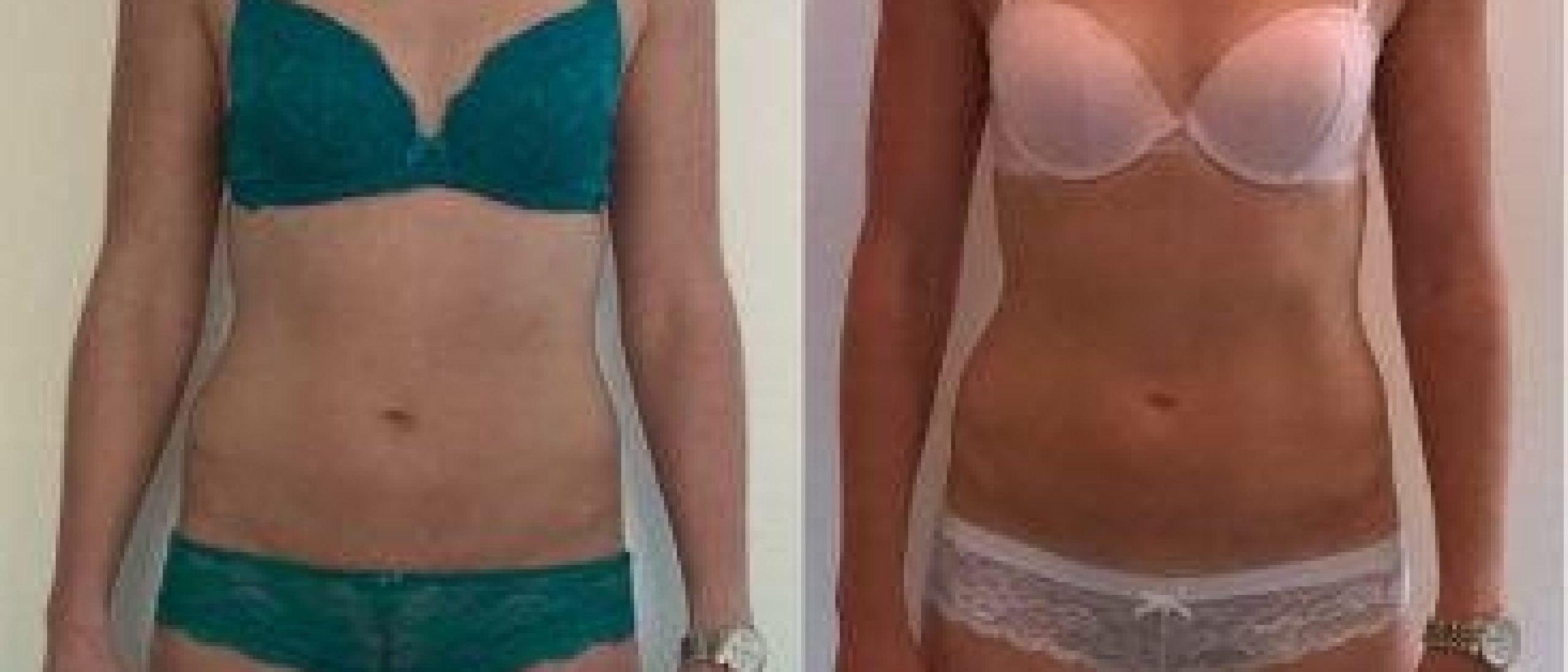 Verschillende vormen van krachttraining, deel 3: hypertrofie 3 Voor-en-na foto's van vrouw in lingerie tonen fitnessresultaat.
