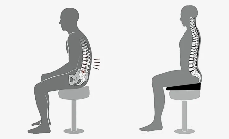Zit tips sit on a wedge especially when you have png